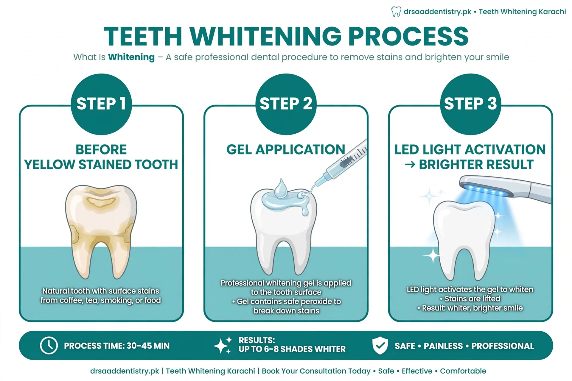 The in-office teeth whitening appointment step by step