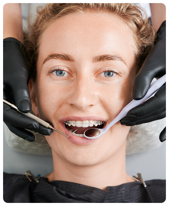 Orthodontic Treatment