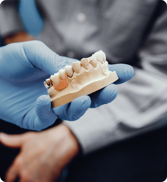 Dental Crowns and Bridges